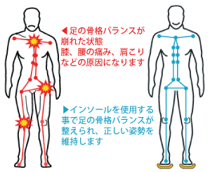 骨格バランス